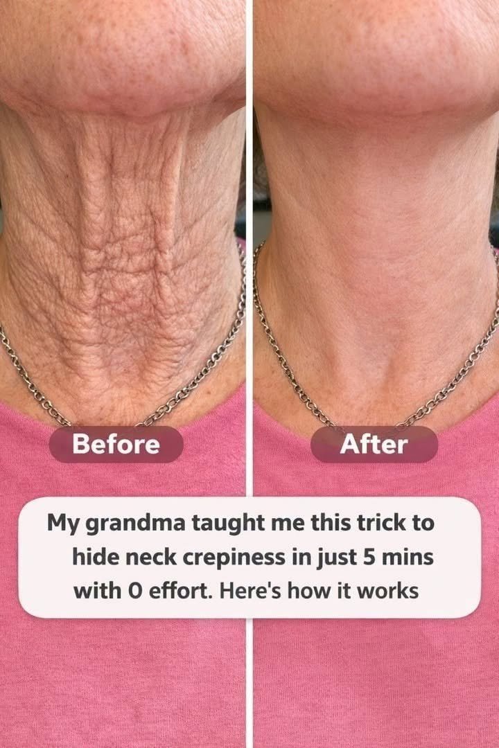 🌿 Simple 5-Minute Neck Care Recipe 823617526_1766808701253752_7351593913977927077_n