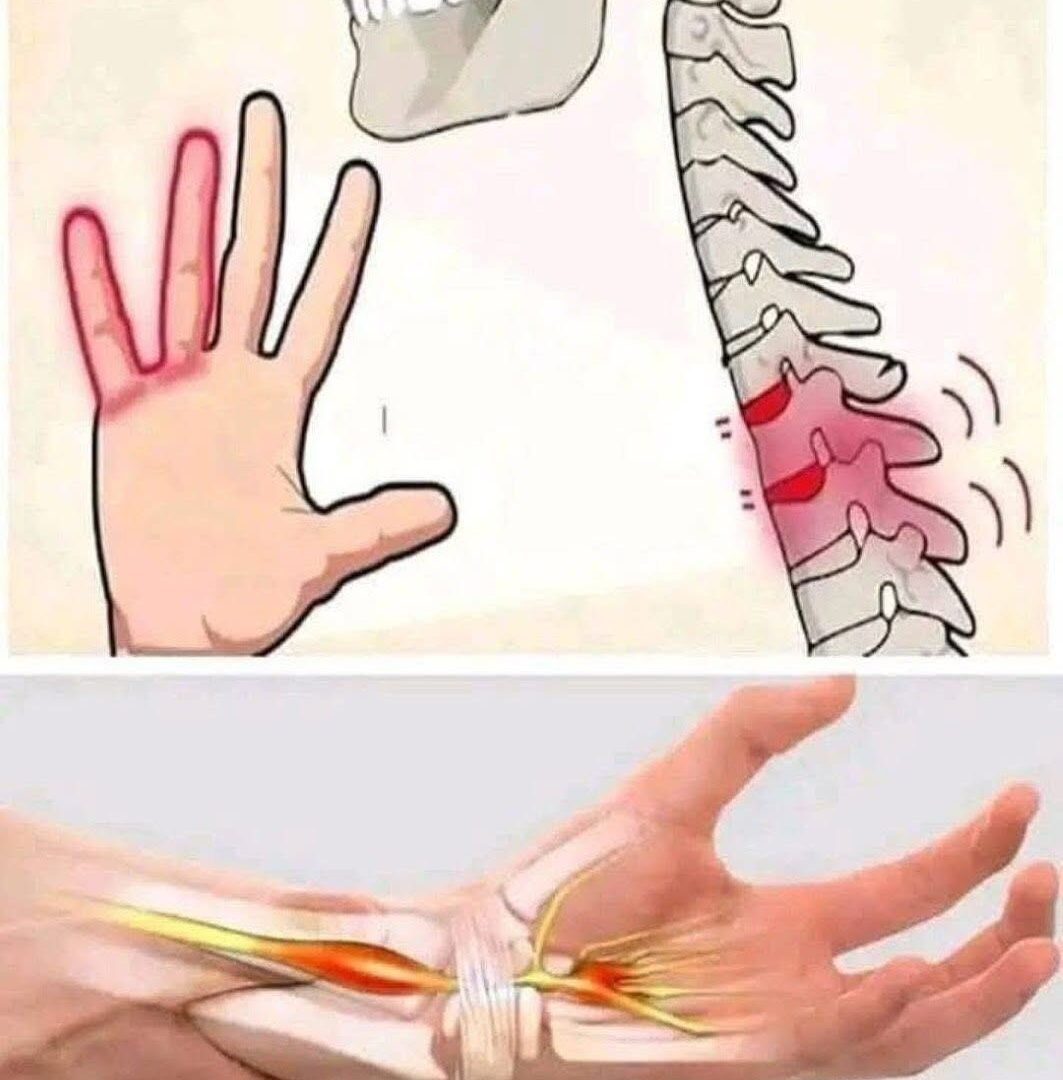 Hands Falling Asleep at Night? Paresthesia: Causes and Solutions 834238711_122267335064164215_3470690730914503323_n